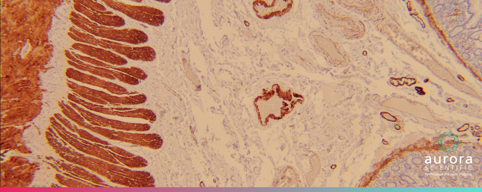 Aurora Scientific - Myosin Binding - 1600x640