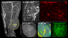 Newswise: New Contrast Agent Combination Could Usher in a New Era of Vascular Systems Biology