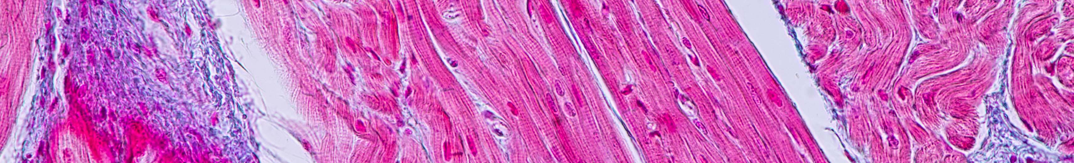 2023 Web Refresh - Cardiac Tissue Slices